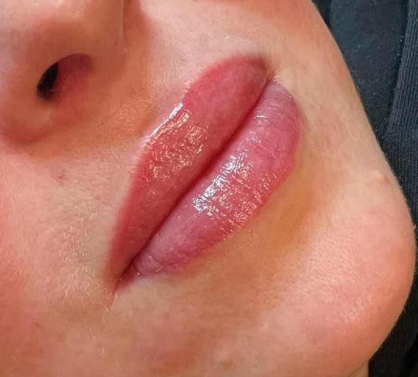 Pigmentointi: huulet